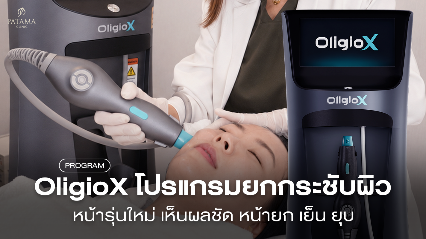 โปรแกรม OligioX คืออะไร? ต่างจากรุ่นทั่วไปยังไง ราคาเท่าไหร่