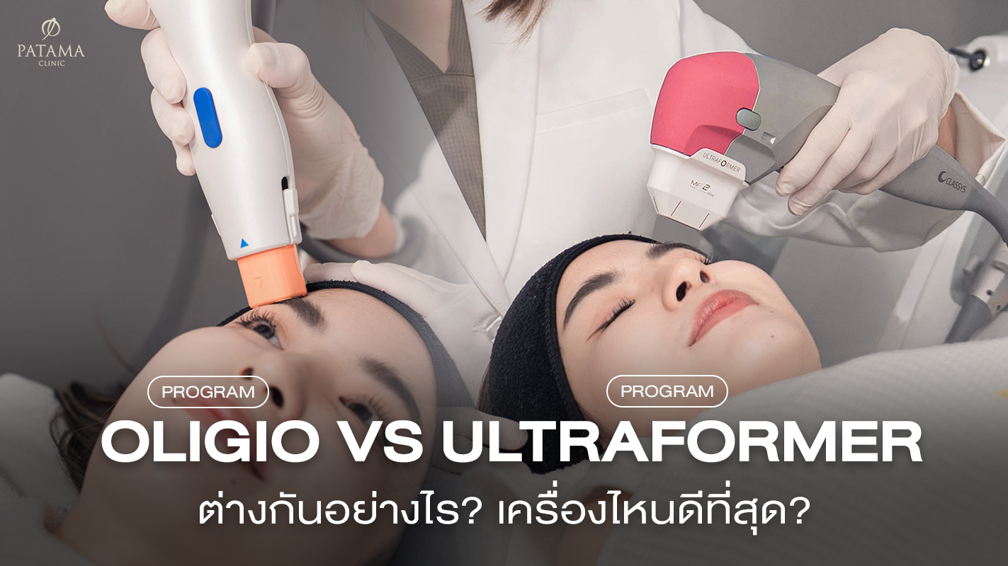 Oligio vs Ultraformer