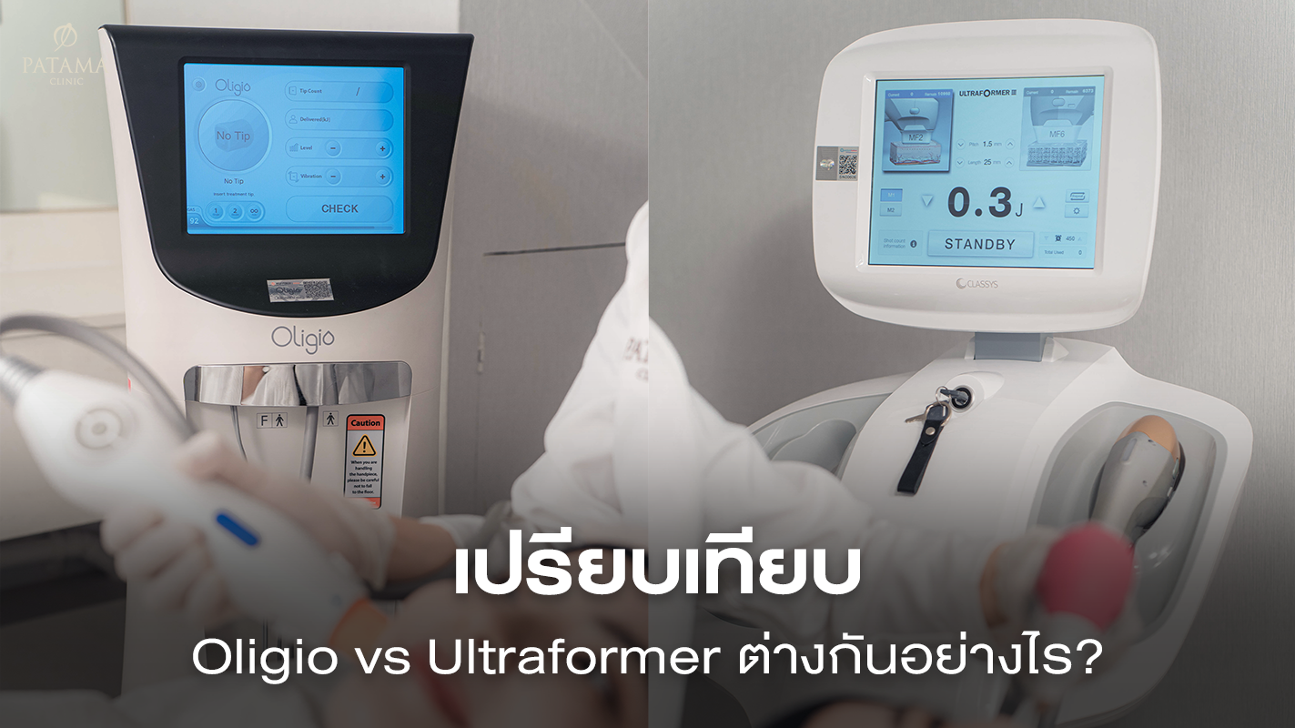 เปรียบเทียบ Oligio vs Ultraformer ต่างกันอย่างไร