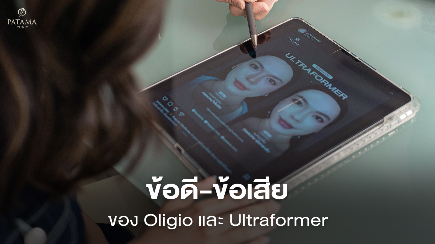 ข้อดี-ข้อเสียของ Oligio และ Ultraformer