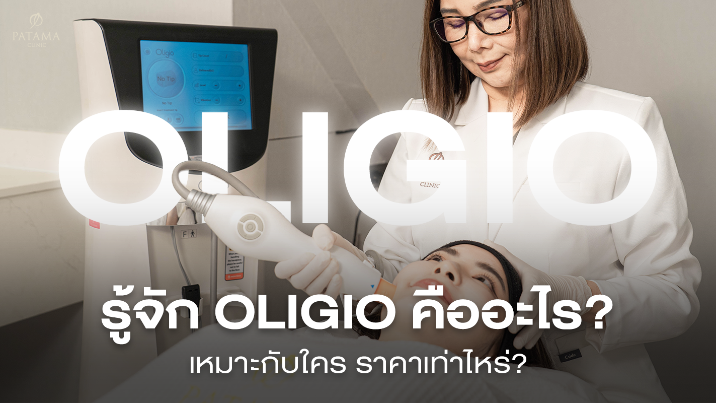 Oligio คืออะไร