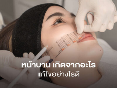 หน้าบานเกิดจากอะไร แก้ไขอย่างไรดี? หน้าเรียวสวย แก้ตรงจุด