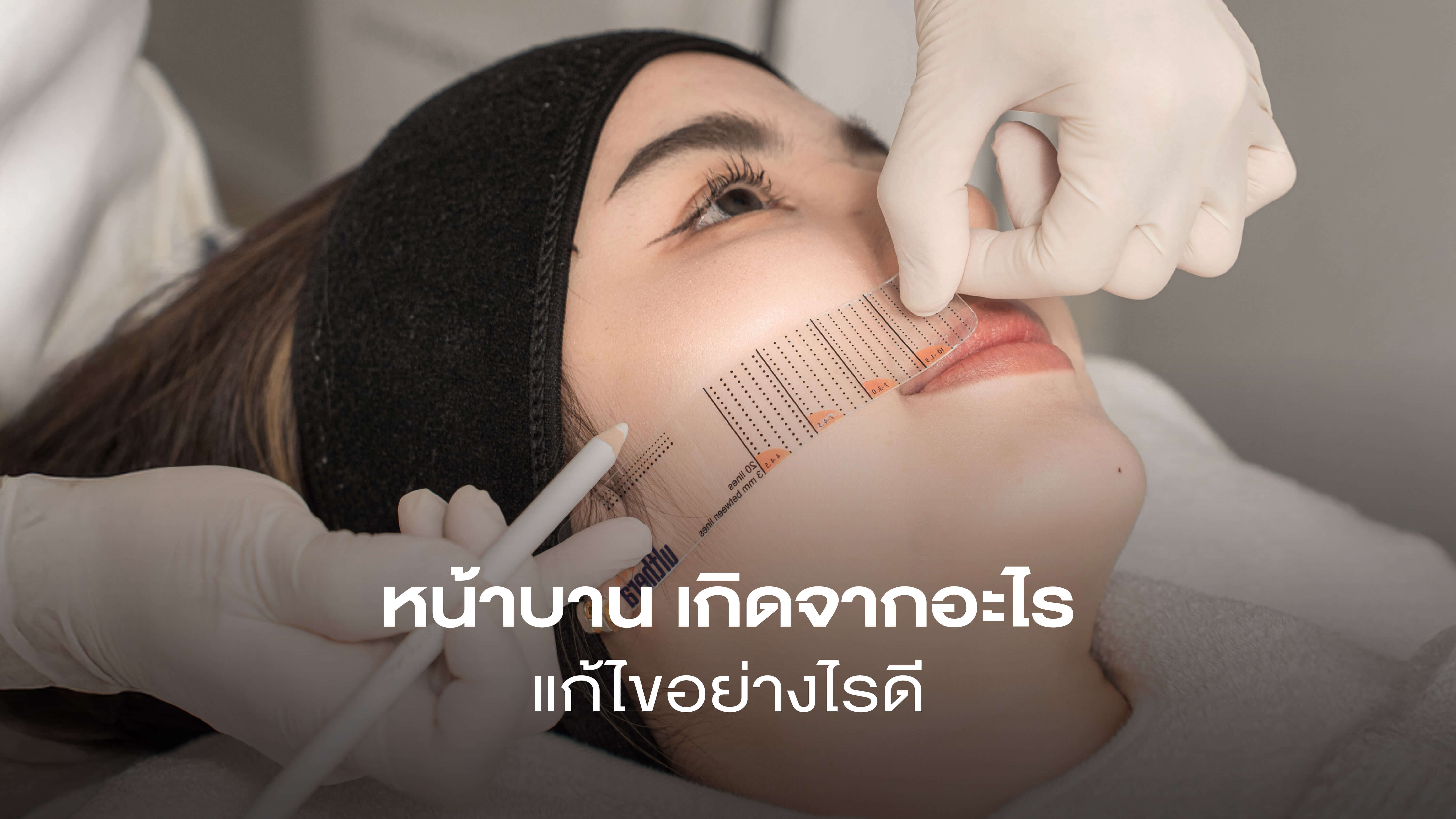 หน้าบานเกิดจากอะไร แก้ไขอย่างไรดี? หน้าเรียวสวย แก้ตรงจุด