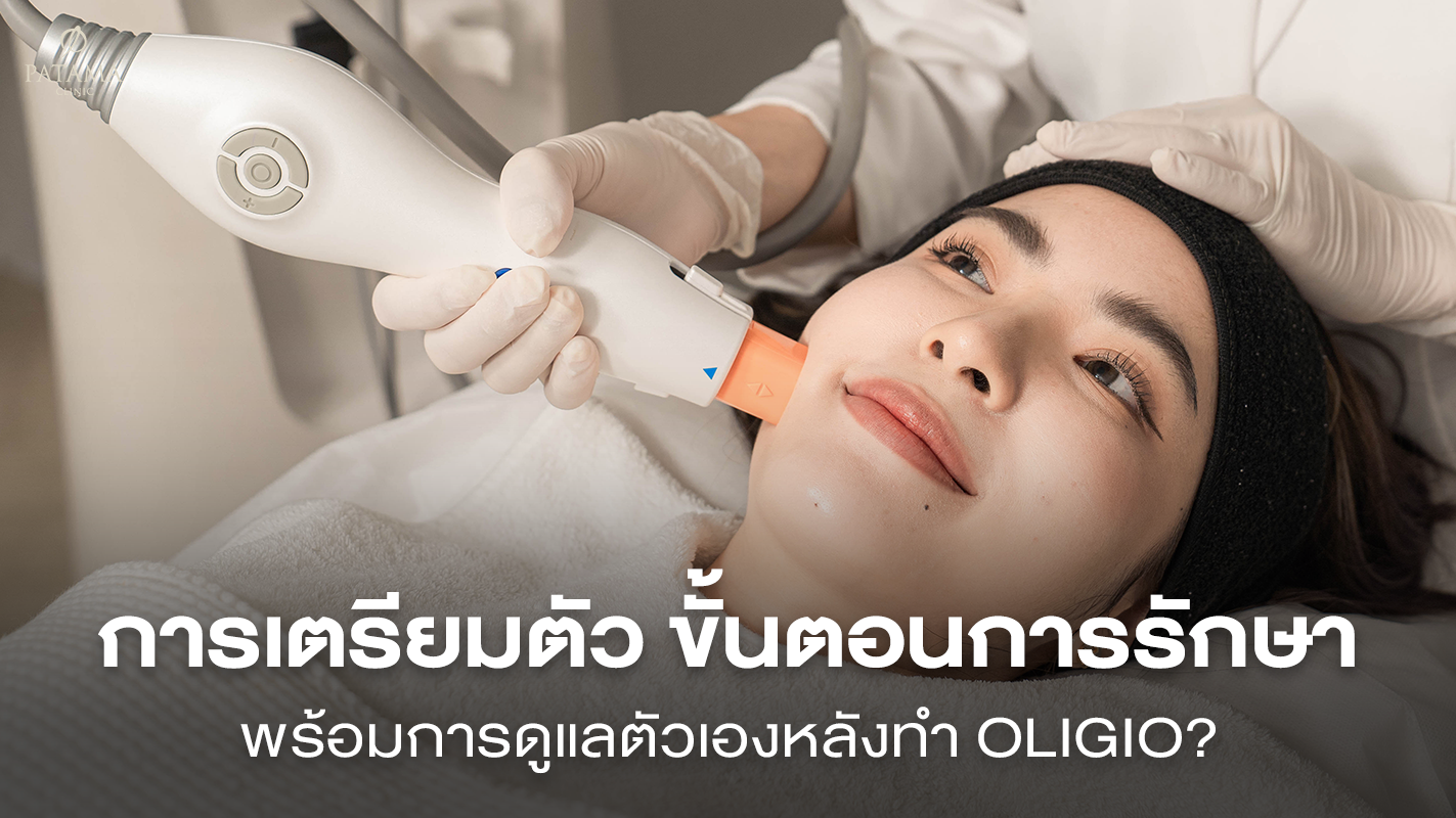 การเตรียมตัวก่อนทำ Oligio