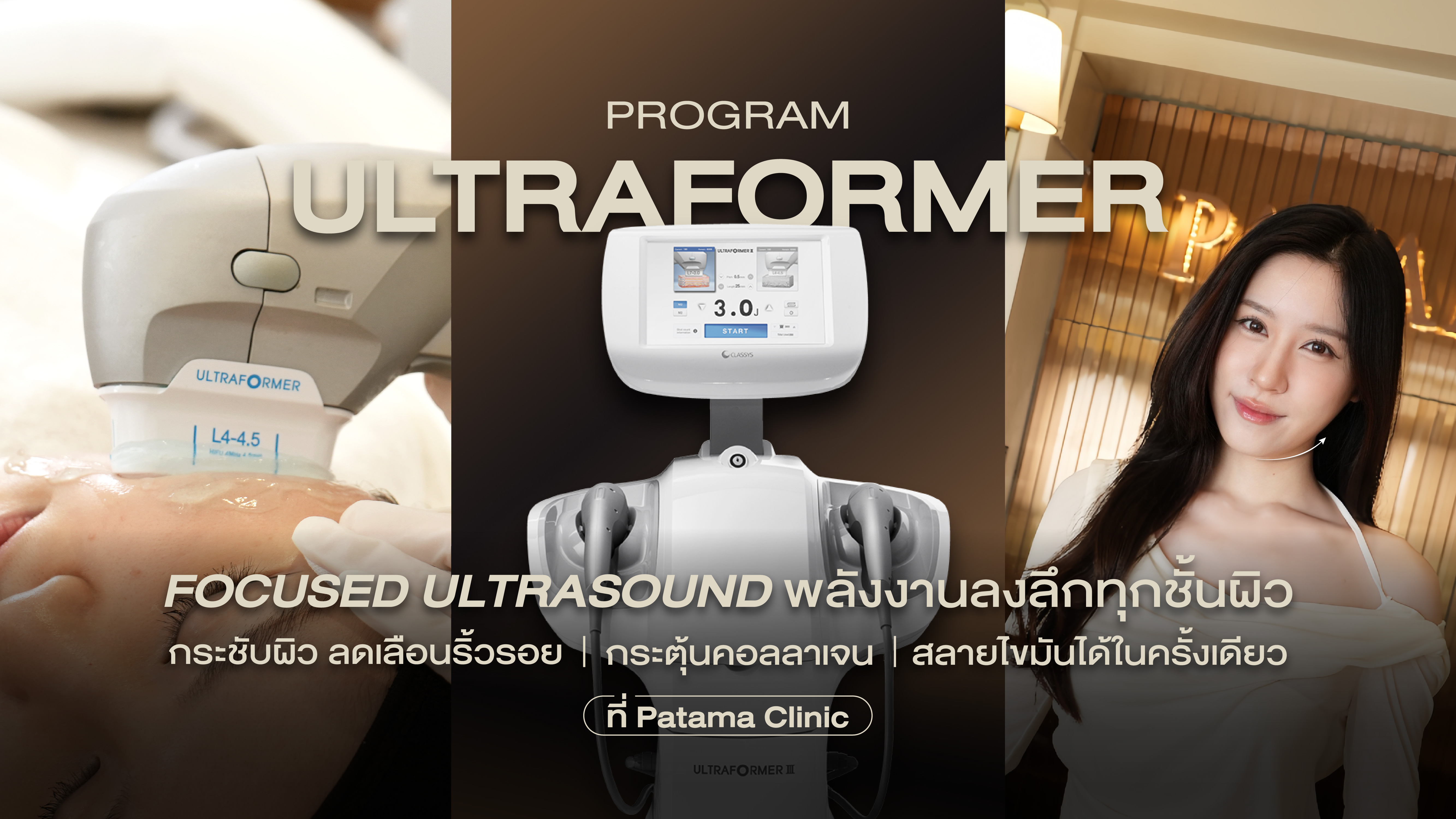 Ultraformer III คืออะไร