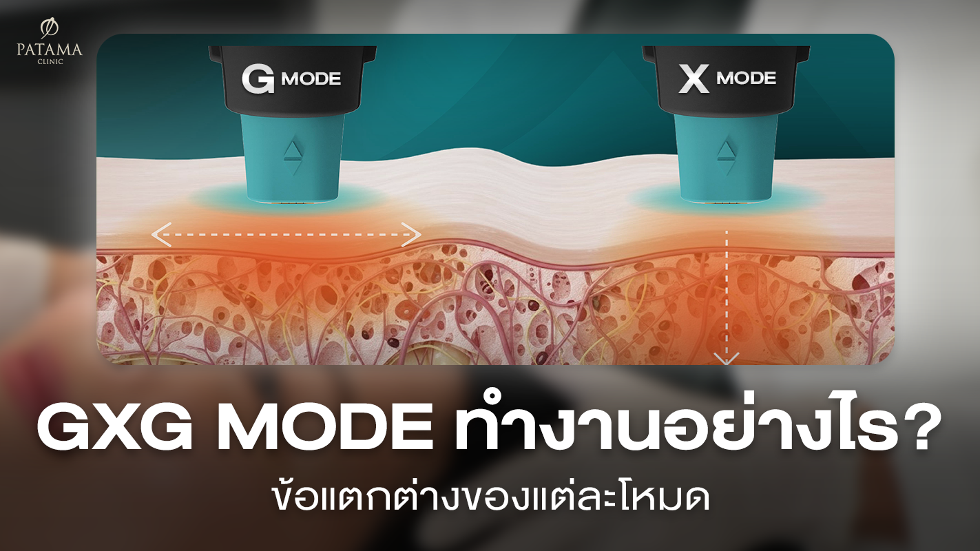 gxg ทำงานอย่างไร