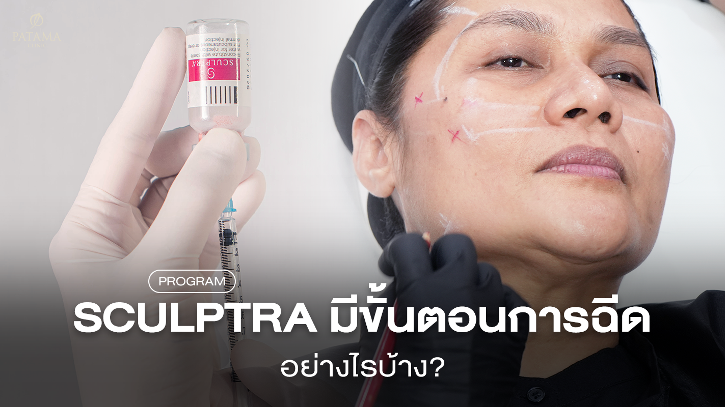 Sculptra มีขั้นตอนการฉีดอย่างไร