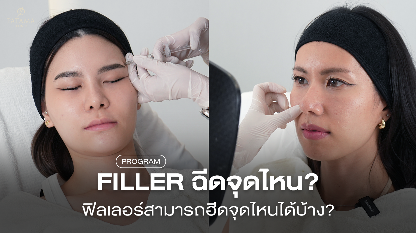 ฟิลเลอร์ฉีดจุดไหนได้บ้าง